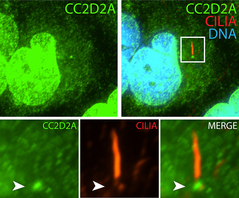 IF result (strong nucleus and the base stain) of anti-CC2D2A (Catalog No:108953, 1:50) with serum-starved hTERT-RPE1 (MeOH fixed) by Dr. Moshe Kim.