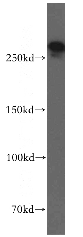 mouse brain tissue were subjected to SDS PAGE followed by western blot with Catalog No:115653(SPTBN1-Specific antibody) at dilution of 1:300
