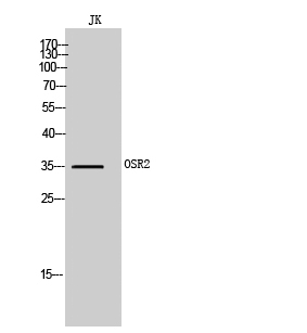 Fig1:; Western Blot analysis of JK cells using OSR2 Polyclonal Antibody cells nucleus extracted by Minute TM Cytoplasmic and Nuclear Fractionation kit (SC-003,Inventbiotech,MN,USA).