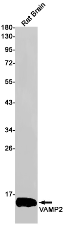 Western blot detection of VAMP2 in Rat Brain lysates using VAMP2 Rabbit pAb(1:1000 diluted).Predicted band size:13kDa.Observed band size:13kDa.