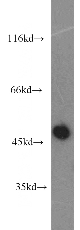 L02 cells were subjected to SDS PAGE followed by western blot with Catalog No:109643(IL8RB antibody) at dilution of 1:2000