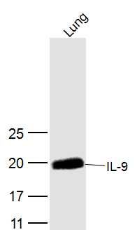 Fig2: Sample:; Lung (Mouse) Lysate at 40 ug; Primary: Anti-IL-9 at 1/300 dilution; Secondary: IRDye800CW Goat Anti-Rabbit IgG at 1/20000 dilution; Predicted band size: 16 kD; Observed band size: 16 kD