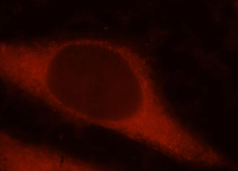 Immunofluorescent analysis of Hela cells, using RAI14 antibody Catalog No:114527 at 1:25 dilution and Rhodamine-labeled goat anti-rabbit IgG (red).
