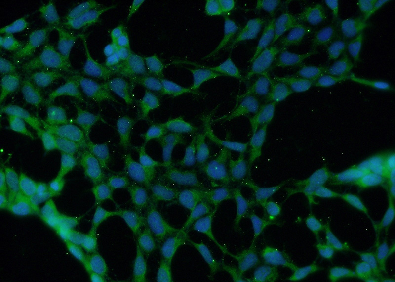 Immunofluorescent analysis of HEK-293 cells using Catalog No:110001(DMAP1 Antibody) at dilution of 1:50 and Alexa Fluor 488-congugated AffiniPure Goat Anti-Rabbit IgG(H+L)