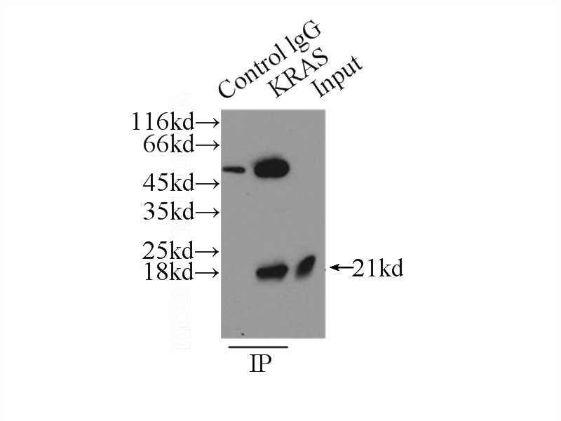 IP Result of anti-KRAS (IP:Catalog No:112119, 3ug; Detection:Catalog No:112119 1:1000) with HeLa cells lysate 2500ug.