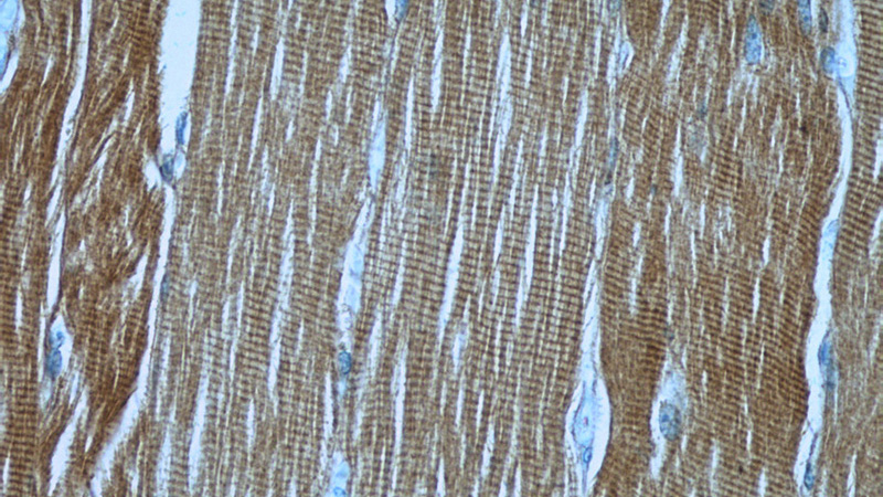 Immunohistochemistry of paraffin-embedded human skeletal muscle slide using Catalog No:114862(RTN2 Antibody) at dilution of 1:50