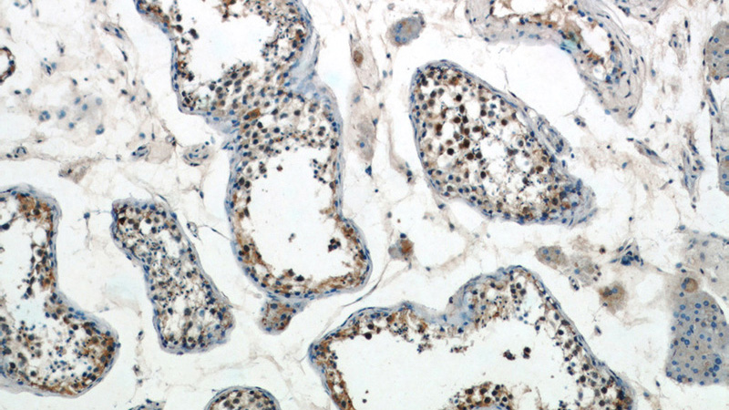 Immunohistochemistry of paraffin-embedded human testis tissue slide using Catalog No:109660(CCNA1 Antibody) at dilution of 1:50 (under 10x lens)