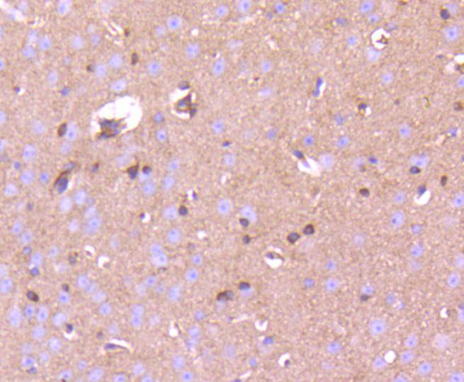 Fig6:; Immunohistochemical analysis of paraffin-embedded mouse brain tissue using anti-Phospho-PAK1(S144)+PAK2(S141)+PAK3(S139) antibody. The section was pre-treated using heat mediated antigen retrieval with Tris-EDTA buffer (pH 8.0-8.4) for 20 minutes.The tissues were blocked in 5% BSA for 30 minutes at room temperature, washed with ddH; 2; O and PBS, and then probed with the primary antibody ( 1/50) for 30 minutes at room temperature. The detection was performed using an HRP conjugated compact polymer system. DAB was used as the chromogen. Tissues were counterstained with hematoxylin and mounted with DPX.