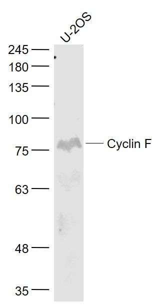 Fig1: Sample:; U-2OS(Human) Cell Lysate at 30 ug; Primary: Anti- Cyclin F at 1/1000 dilution; Secondary: IRDye800CW Goat Anti-Rabbit IgG at 1/20000 dilution; Predicted band size: 86 kD; Observed band size: 86 kD