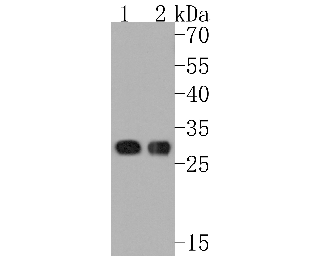 Fig2:; Western blot analysis of CLIC2 on different lysates. Proteins were transferred to a PVDF membrane and blocked with 5% NFDM/TBST for 1 hour at room temperature. The primary antibody ( 1/500) was used in 5% NFDM/TBST at room temperature for 2 hours. Goat Anti-Mouse IgG - HRP Secondary Antibody (HA1006) at 1:20,000 dilution was used for 1 hour at room temperature.; Positive control:; Lane 1: Human liver tissue lysate; Lane 2: Human skeletal muscle tissue lysate