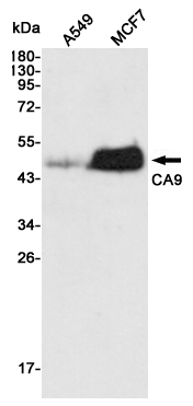 Western blot detection of CA9 in A549 and MCF7 cell lysates using CA9 mouse mAb (1:5000 diluted).Predicted band size:50KDa.Observed band size:50KDa.