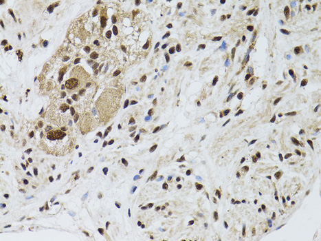 Immunohistochemistry - LKB1 Polyclonal Antibody 