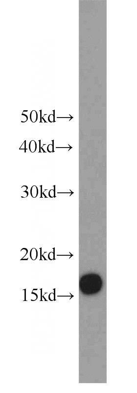 HEK-293 cells were subjected to SDS PAGE followed by western blot with Catalog No:116515(UBE2A antibody) at dilution of 1:600