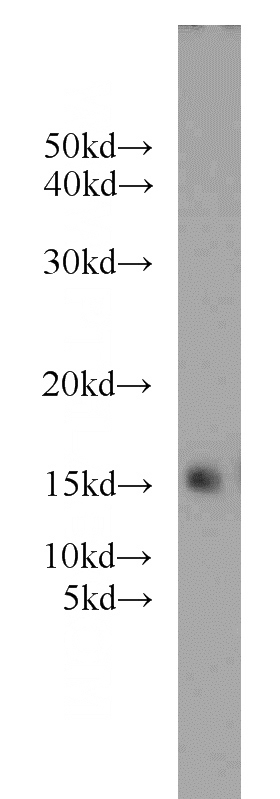 human brain tissue were subjected to SDS PAGE followed by western blot with Catalog No:114309(PTN antibody) at dilution of 1:800