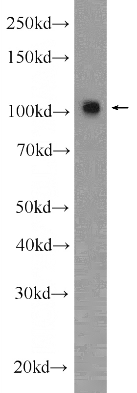 mouse brain tissue were subjected to SDS PAGE followed by western blot with Catalog No:111141(GRIN1 Antibody) at dilution of 1:600