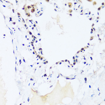 Immunohistochemistry - BRIX1 Polyclonal Antibody 