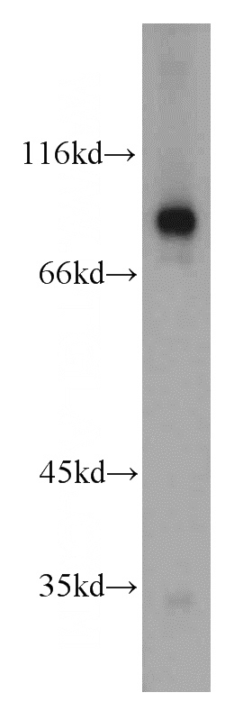 mouse kidney tissue were subjected to SDS PAGE followed by western blot with Catalog No:116028(TGM1 antibody) at dilution of 1:500