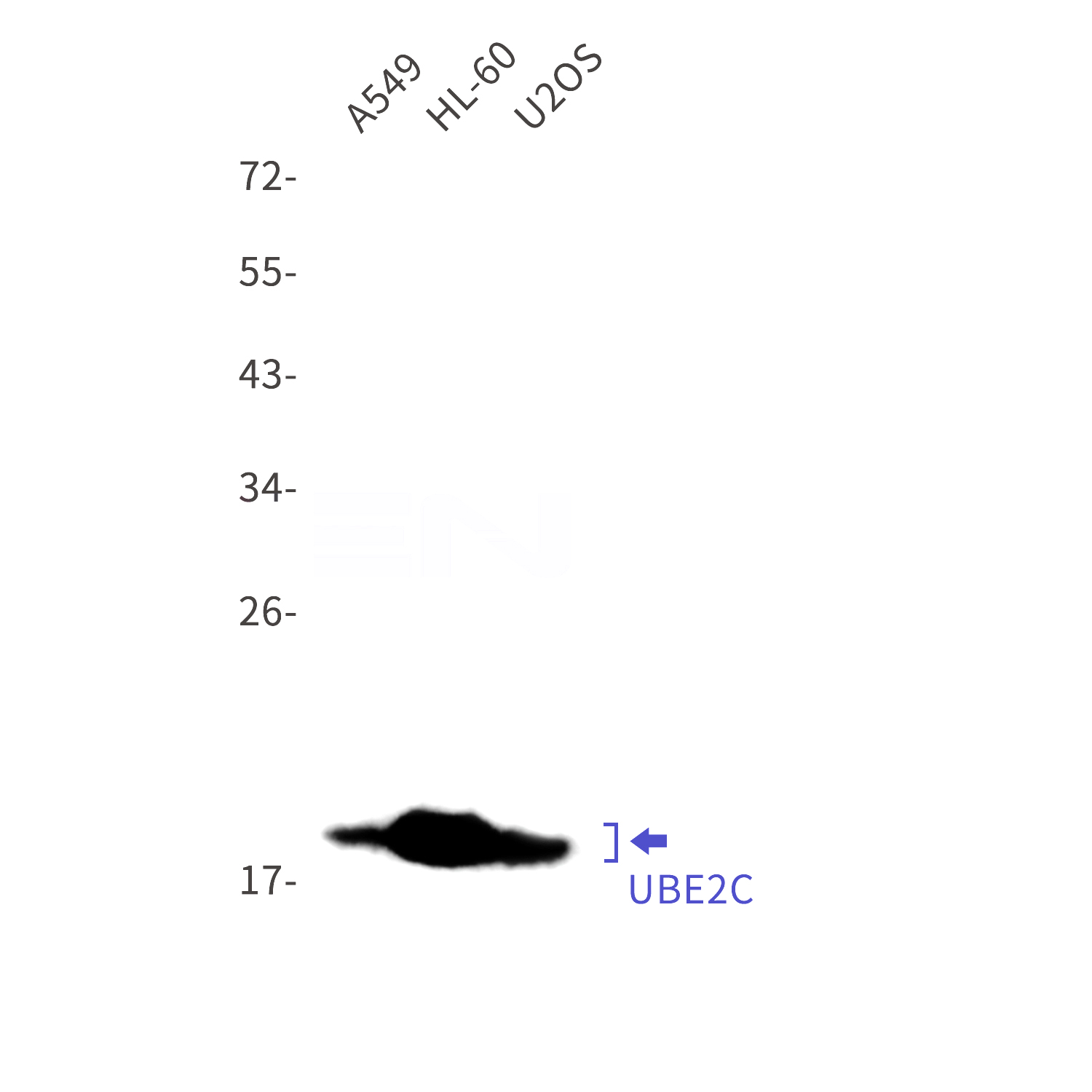 Western blot detection of UBE2C in A549,HL-60,U2OS cell lysates using UBE2C Rabbit mAb(1:1000 diluted).Predicted band size:20kDa.Observed band size:20kDa.