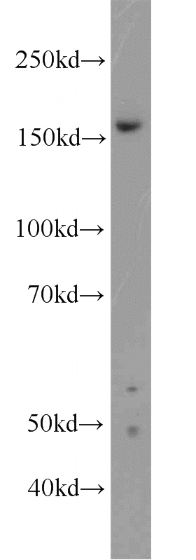 HEK-293 cells were subjected to SDS PAGE followed by western blot with Catalog No:117275(ZZZ3 antibody) at dilution of 1:1000