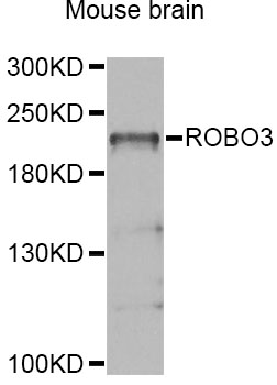 Western blot - ROBO3 Polyclonal Antibody 