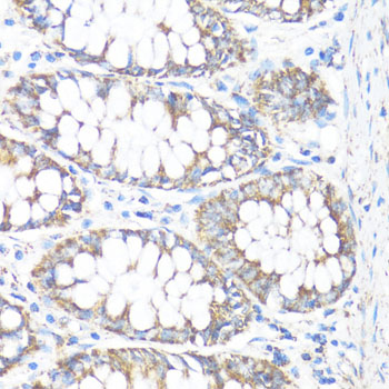 Immunohistochemistry - HSD17B10 Polyclonal Antibody 