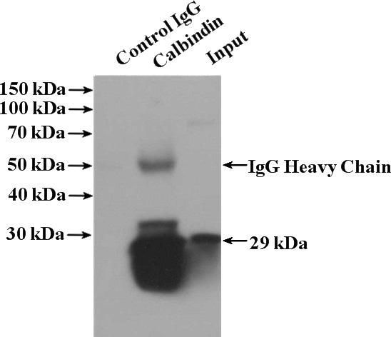 IP Result of anti-Calbindin (IP:Catalog No:108815, 4ug; Detection:Catalog No:108815 1:1000) with mouse brain tissue lysate 4000ug.
