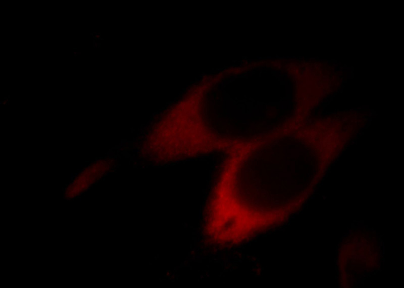Immunofluorescent analysis of MCF-7 cells, using ASS1 antibody Catalog No: at 1:50 dilution and Rhodamine-labeled goat anti-mouse IgG (red).