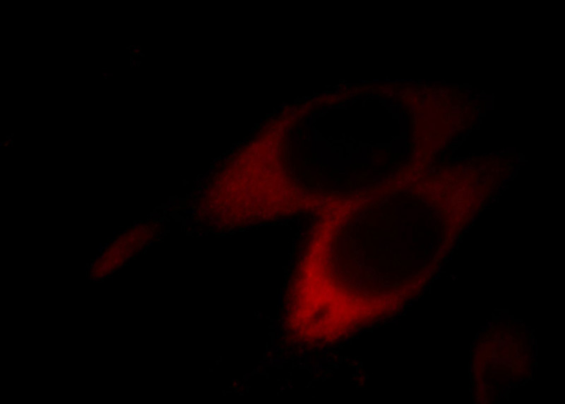 Immunofluorescent analysis of MCF-7 cells, using ASS1 antibody Catalog No: at 1:50 dilution and Rhodamine-labeled goat anti-mouse IgG (red).