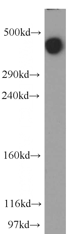 mouse cerebellum tissue were subjected to SDS PAGE followed by western blot with Catalog No:112472(MAP1B antibody) at dilution of 1:500