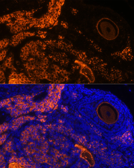 Immunofluorescence - ZP3 Polyclonal Antibody 