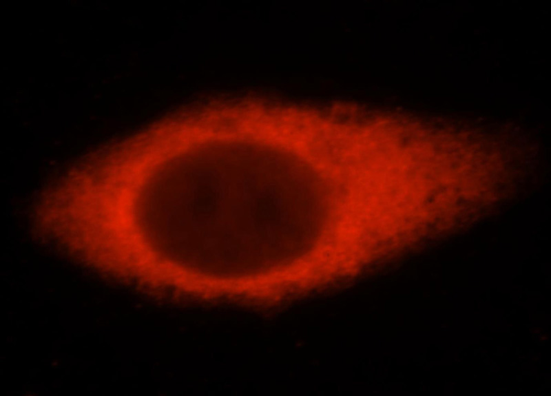 Immunofluorescent analysis of HepG2 cells, using USP14 antibody Catalog No:116591 at 1:25 dilution and Rhodamine-labeled goat anti-rabbit IgG (red).