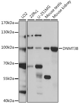 Western blot - DNMT3B Polyclonal Antibody 