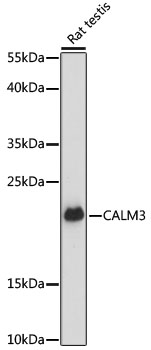 Western blot - CALM3 Polyclonal Antibody 