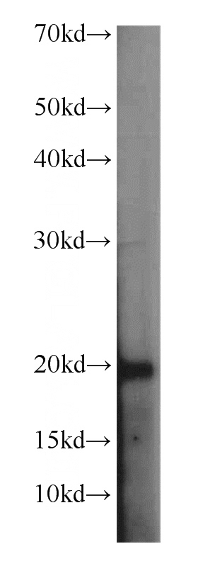 HeLa cells were subjected to SDS PAGE followed by western blot with Catalog No:115448(SNAPC5 antibody) at dilution of 1:500