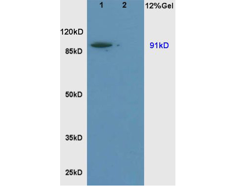 Fig1: Sample:; Brain(Rat) lysate at 30ug;; Liver(Rat) lysate at 30ug;; Primary: Anti-NHE1 at 1:200 dilution;; Secondary: HRP conjugated Goat-Anti-Rabbit IgG(bse-0295G) at 1: 3000 dilution;; Predicted band size : 91kD; Observed band size : 91kD; We are unsure as to the identity of these extra bands