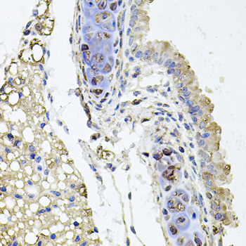 Immunohistochemistry - RHOT1 Polyclonal Antibody 