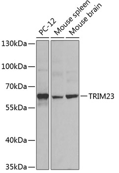 Western blot - TRIM23 Polyclonal Antibody 
