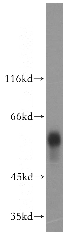 human blood tissue were subjected to SDS PAGE followed by western blot with Catalog No:116759(VDBP,GC antibody) at dilution of 1:1500