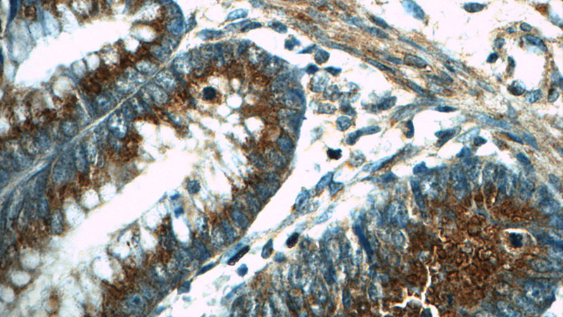 Immunohistochemistry of paraffin-embedded human colon tissue slide using Catalog No:116661(UBQLNL Antibody) at dilution of 1:50