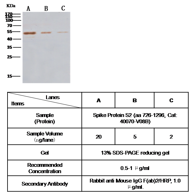 MERS-CoV (HCoV-EMC/2012) Nucleocapsid Antibody, Mouse MAb, Western blot