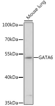 Western blot - GATA6 Polyclonal Antibody 