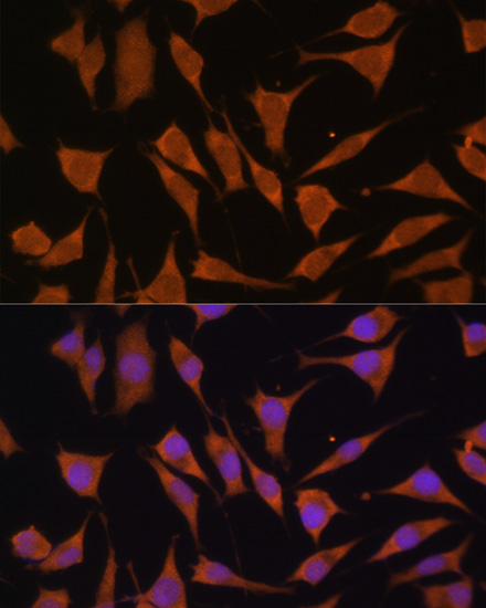 Immunofluorescence - GLB1 Polyclonal Antibody 