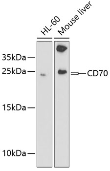 Western blot - CD70 Polyclonal Antibody 