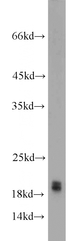 mouse brain tissue were subjected to SDS PAGE followed by western blot with Catalog No:107879(SNCA antibody) at dilution of 1:1000
