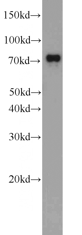 Jurkat cells were subjected to SDS PAGE followed by western blot with Catalog No:115862(TBC1D17 antibody) at dilution of 1:1000