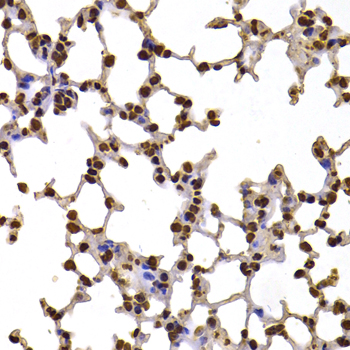 Immunohistochemistry - FBXW7 Polyclonal Antibody 
