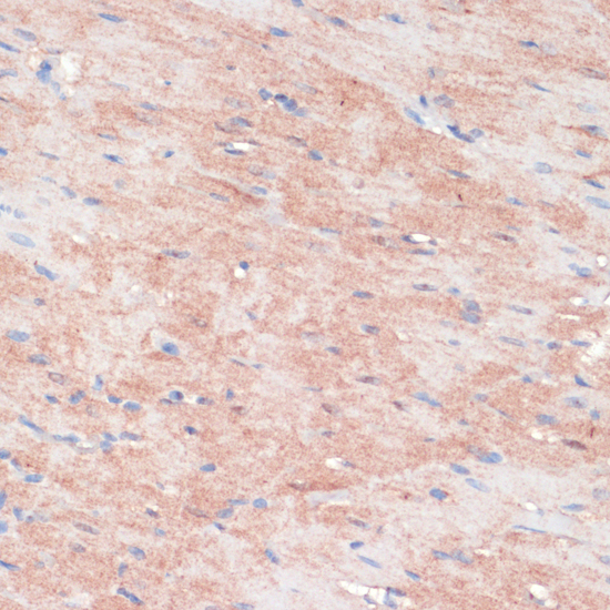 Immunohistochemistry - RPIA Polyclonal Antibody 