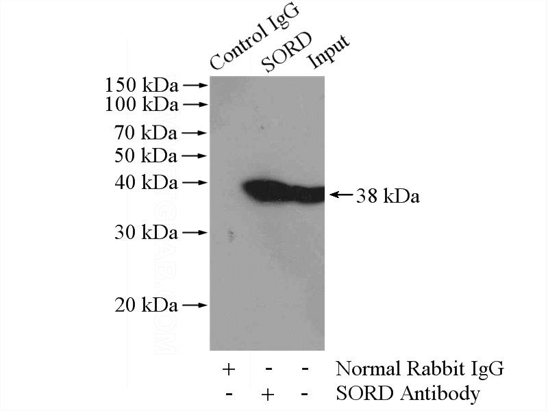 IP Result of anti-SORD (IP:Catalog No:115500, 4ug; Detection:Catalog No:115500 1:1000) with mouse liver tissue lysate 4000ug.