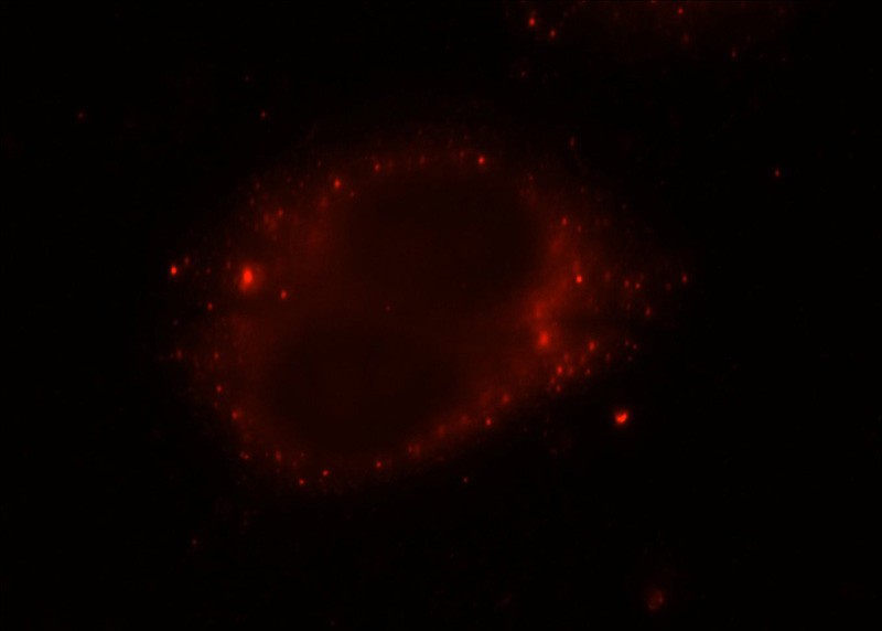 Immunofluorescent analysis of HepG2 cells using Catalog No:115262(SH3PXD2A Antibody) at dilution of 1:25 and Rhodamine-Goat anti-Rabbit IgG