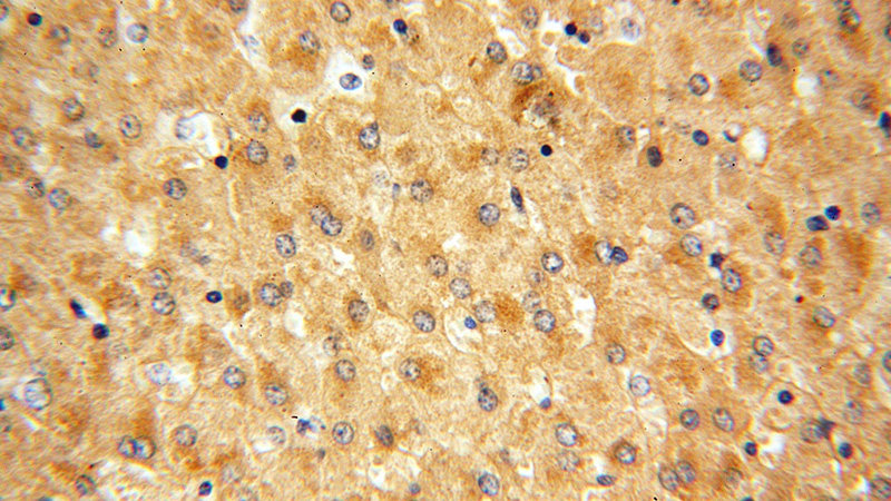 Immunohistochemical of paraffin-embedded human liver using Catalog No:108031(APOF antibody) at dilution of 1:50 (under 40x lens)
